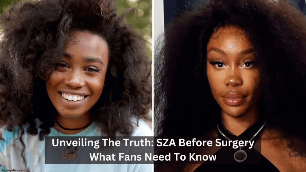 SZA Before Surgery - Did She Get A Plastic Surgery?